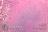 Histo, Chondrodermatitis nodularis helicis, Abb. 3.jpg
